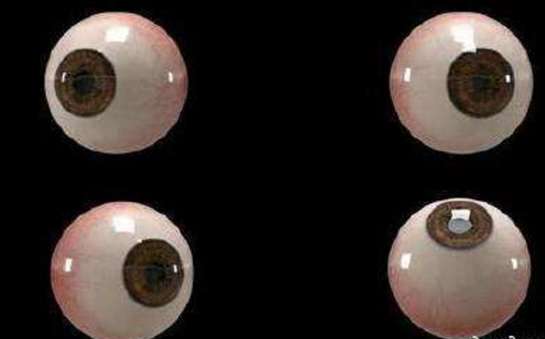 世界首個(gè)3D人工眼球問(wèn)世,數百萬(wàn)人將重見(jiàn)光明